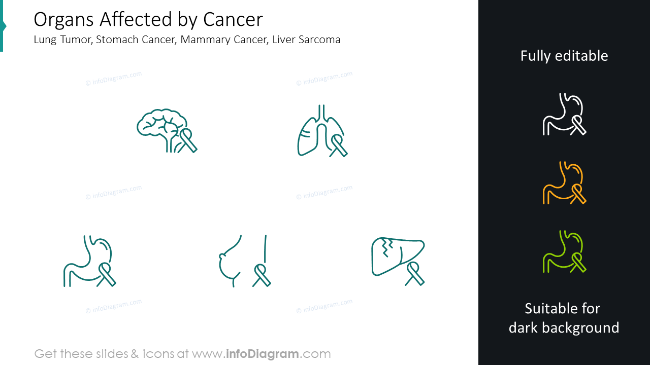 Órganos afectados por el cáncer: tumor de pulmón, cáncer de estómago